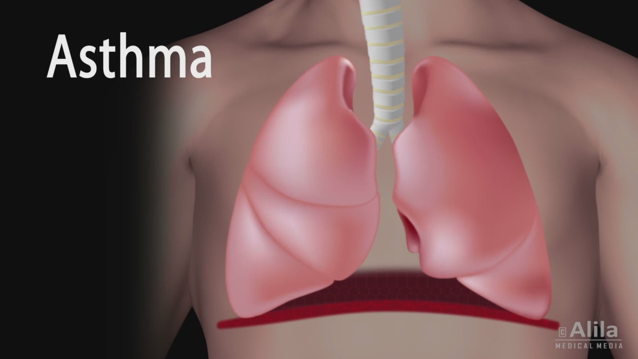 NL100 Piston Nebulizer