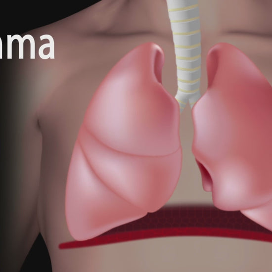 NL100 Piston Nebulizer