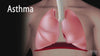NL100 Piston Nebulizer