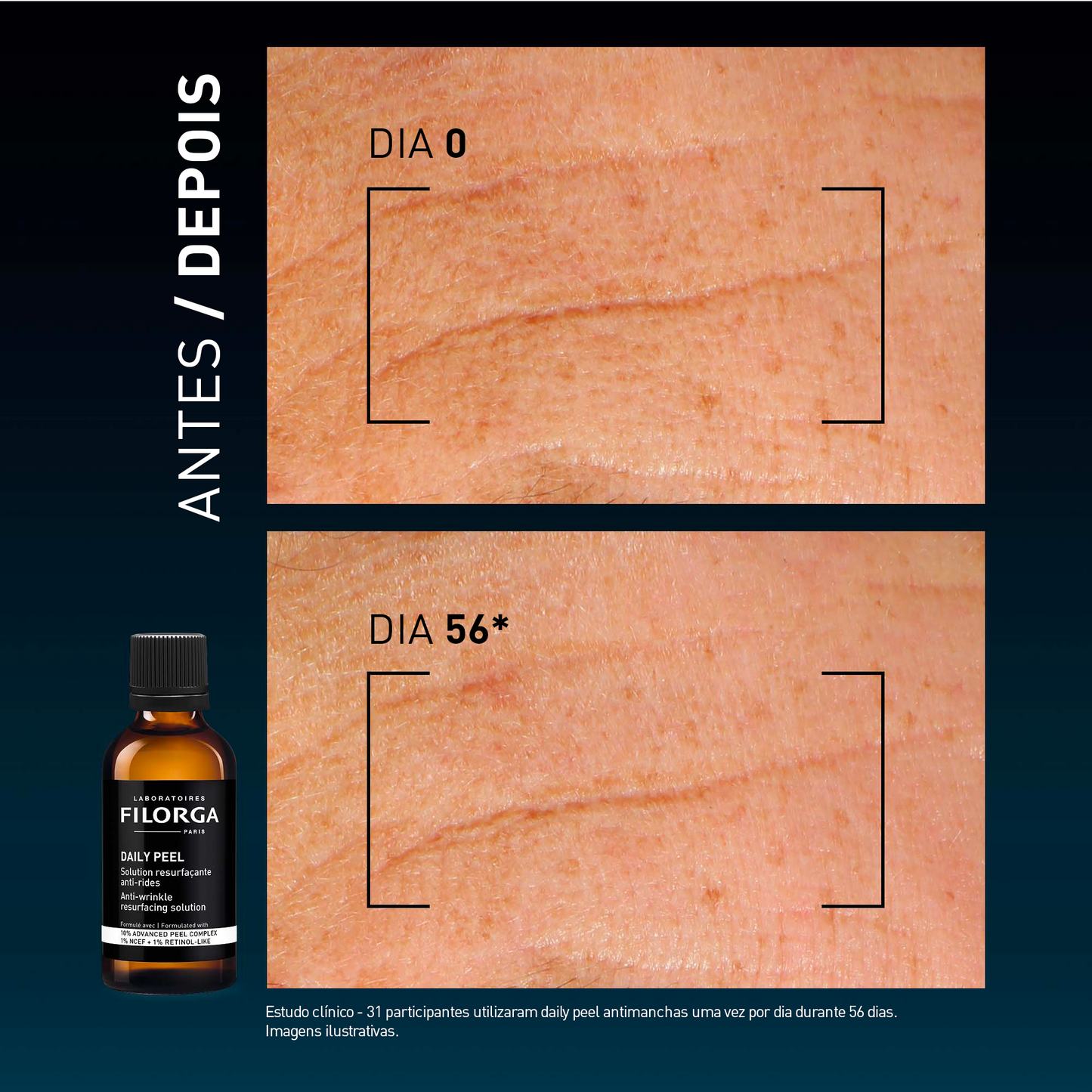 DAILY PEEL – WRINKLES