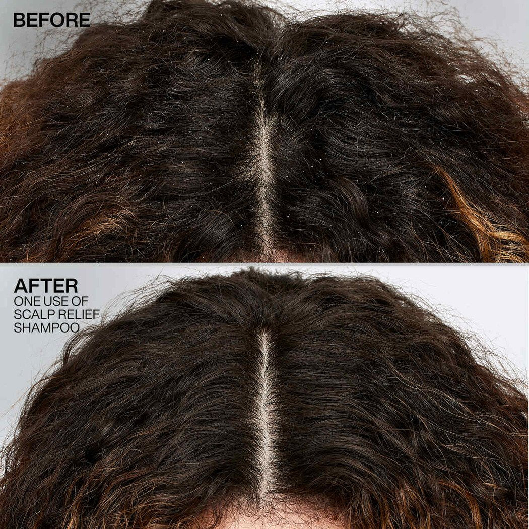 Redken Scalp Relief Dandruff Control Shampoo