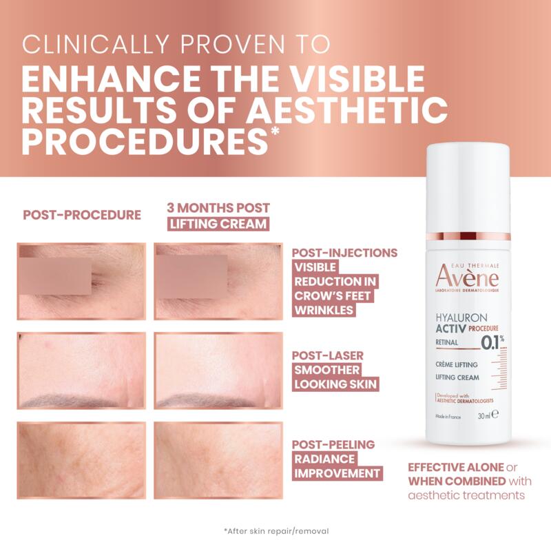 Lifting Cream - 0.1% Retinal